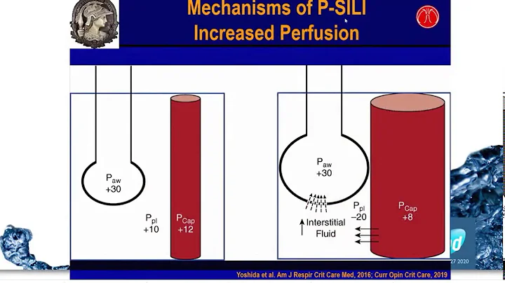 Importance of P SILI in COVID Patricia Rocco