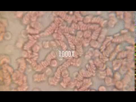 Кровь под микроскопом / Blood under microscope - YouTube