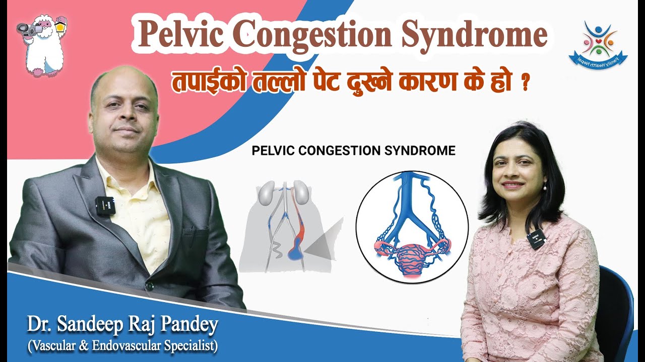 Episode 159: Pelvic Congestion Syndrome:  तपाईको तल्लो पेट दुख्ने कारण के हो ? Dr Sandeep Raj Pandey