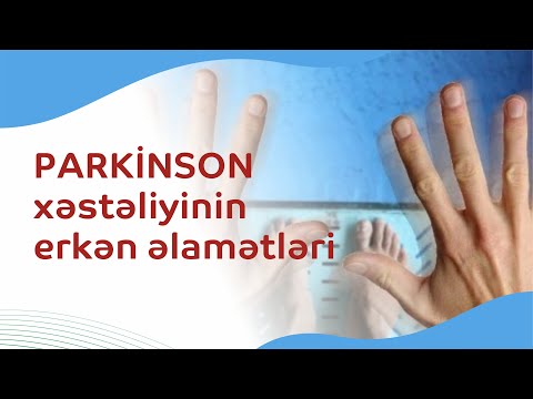 Video: Metodun üstünlüyü ilə metodun gizlədilməsi arasında fərq nədir?