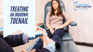 Treating an Ingrown Toenail | Kansas Foot Center