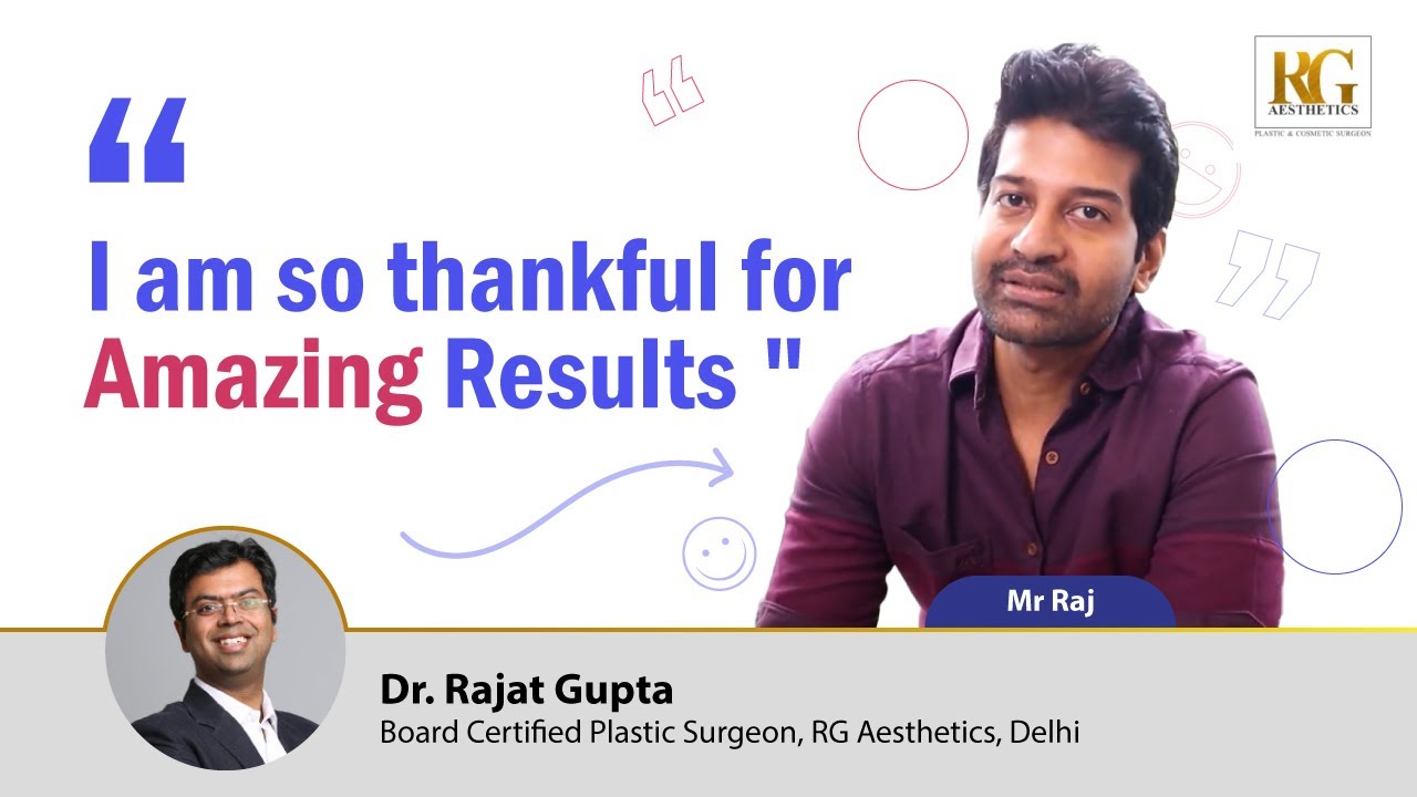 " I am so thankful for Amazing Results " | Rhinoplasty Surgery |  Patient Review | Dr Raja