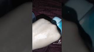 Double Chin & Stretch Marks Solution | Results Guaranteed