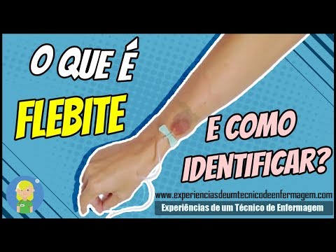 Vídeo: Flebite - Flebite Pós-injeção