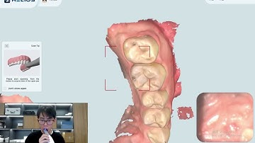 1 Helios 500 Intraoral Scanning Techniques