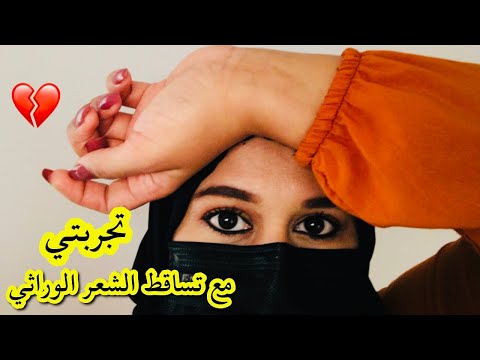 تجربتي الحزينة مع علاج الصلع الوراثي روتين علاج تساقط الشعر الوراثي