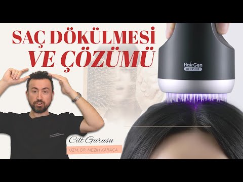 Erkeklerde Saç Dökülmesi (Kellik) ve Kadınlarda Görülen Erkek Tipi Saç Dökülmesi Nasıl Çözülür?