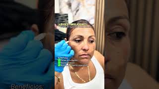 Tratamientos Inyectables #injectablefillers #injectables #botox