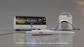 Varicose Vein RFA procedure 3D video