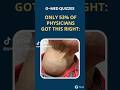Only 53% of Physicians Got This Thyroid Case Right | Can You Diagnose It?
