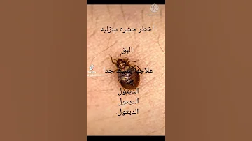 قاتل البق 