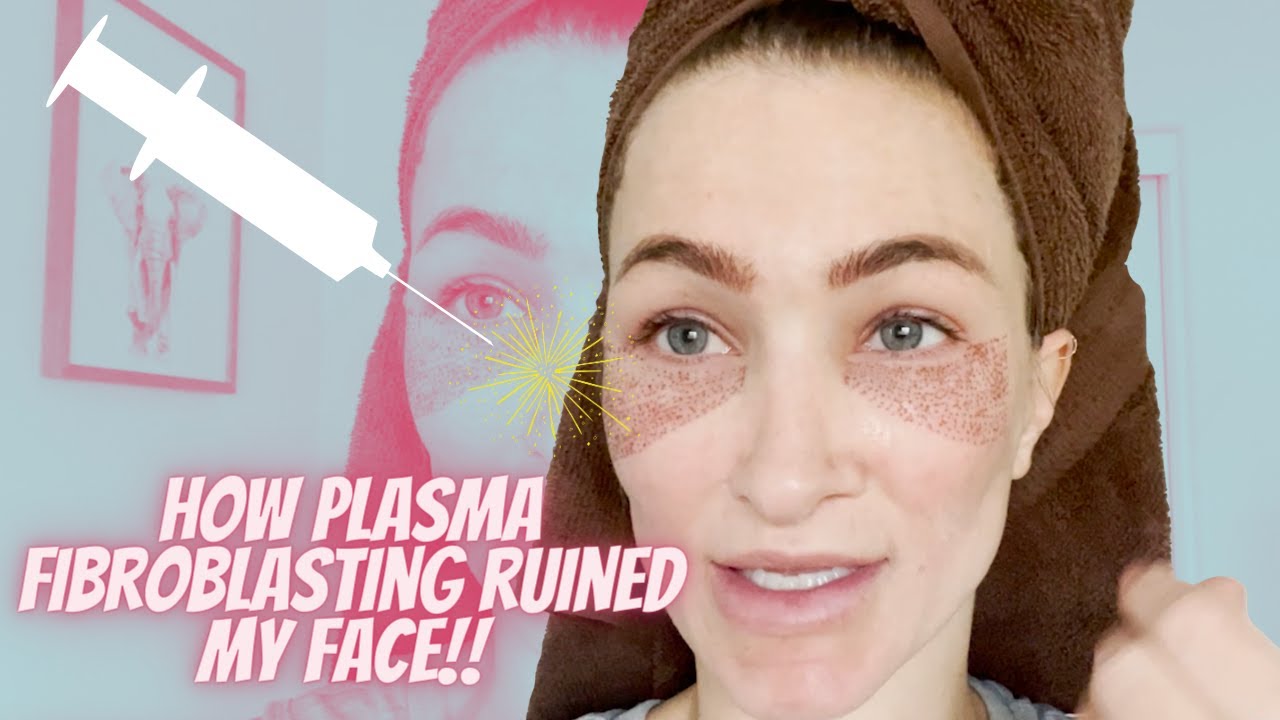 Did Plasma Fibroblast Ruin My face?