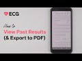 Fitbit Sense ECG – How to View Past Results (and Export to PDF)