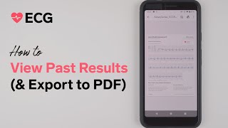 Fitbit Sense ECG – How to View Past Results (and Export to PDF)