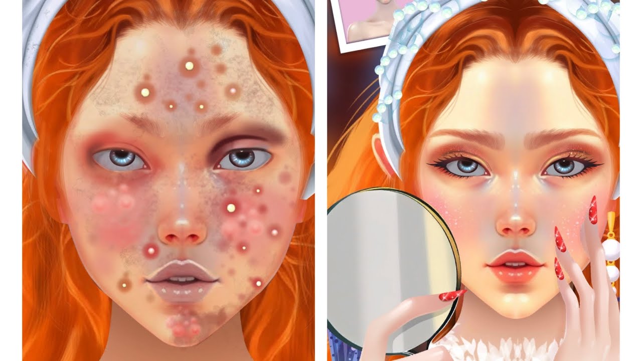 ASRM Face Pimple Removal Deep Cleaning Animation Point ASRM YouTube