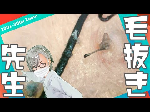 161 [200x Zoom] Mysterious and comfortable video Dr. tweezers 毛抜き先生の角栓や毛根