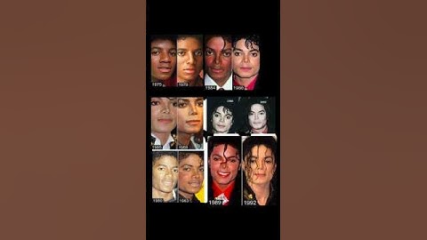 El Vitiligo de Michael Jackson: Entre los Rumores y la Realidad #shorts