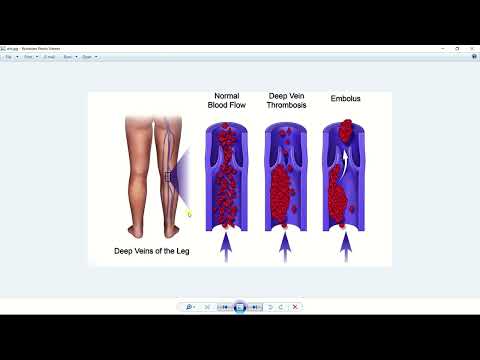 تست شماره 7 از کتاب ساندرز آموزش رایگان ساندرز