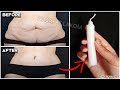 With one candle, your belly fat will melt in one day without diet and exercises