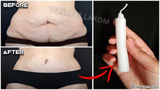 With one candle, your belly fat will melt in one day without diet and exercises screenshot 4