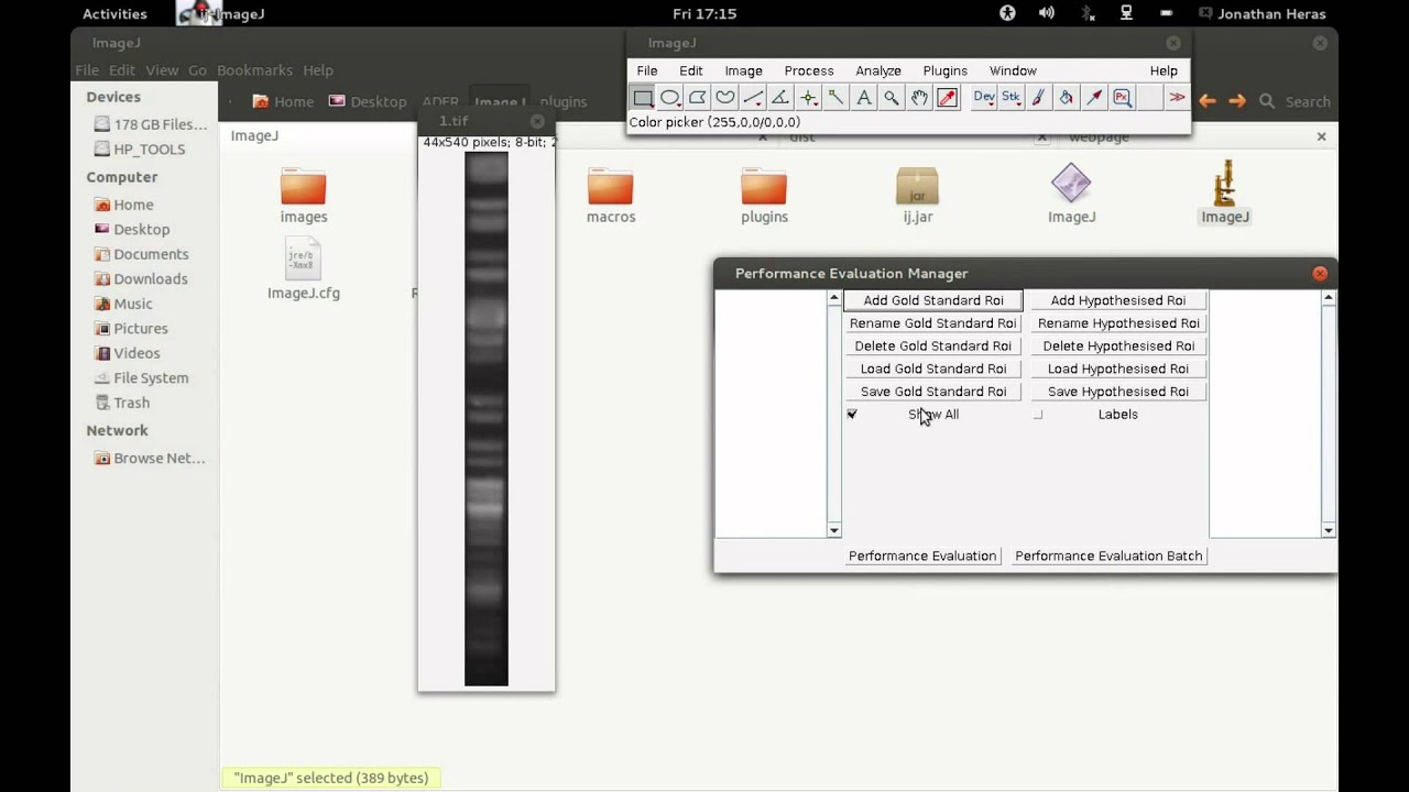 Surveying And Benchmarking Techniques To Analyse Dna Gel