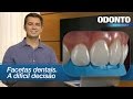 Facetas Dentais: A Difícil Decisão | Leonardo Muniz