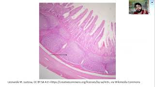 Peyer's Patches and Spleen, Immunology Lecture 7.2