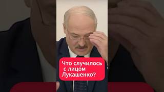 Что случилось с лицом Лукашенко?