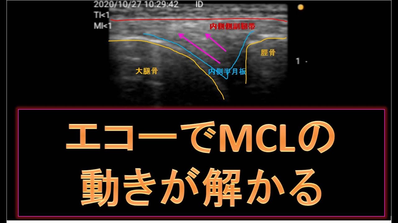 エコー動態 内側側副靭帯 自動膝関節伸展 長軸画像 Youtube