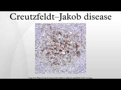 What are the symptoms of Creutzfeldt-Jakob disease?