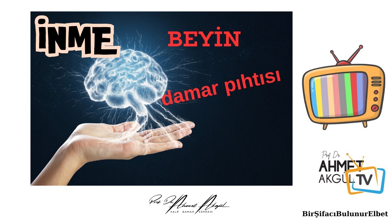 İskemik İnme (Beyne Pıhtı Atması) Kimleri Tehdit Ediyor? - Prof. Dr. Ahmet AKGÜL