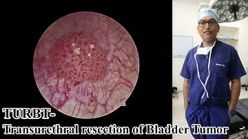 TURBT-Transurethral resection of Bladder Tumor|Dr Brojen Barman