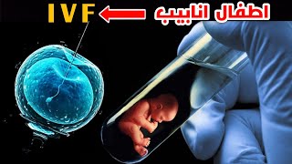 يعني اية اطفال انابيب؟! _ The difference between IVF and ICSI