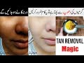 Magical Secret to Remove  SUN TAN 🌞 from Skin in this Summer & Whitening Tips