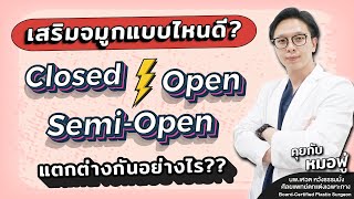 รู้ให้ลึกก่อนทำจมูก!! เสริมจมูกมีกี่แบบ? ควรเลือกเสริมจมูกแบบไหนดี ถึงจะปัง พร้อมข้อดีและเสีย