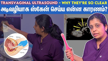 Abdominal or Transvaginal ultrasound? | கர்ப்ப காலத்தில் அடி வழியாக ஸ்கேன் செய்வது அவசியமா?