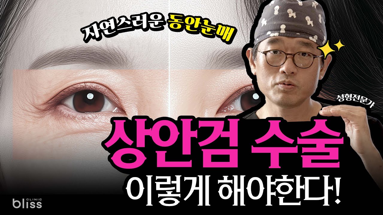 자연스러운 동안눈매, 상안검 수술 욕심부리면 큰일나😮