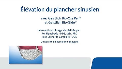 Élévation du plancher sinusien ave Geistlich Bio-Oss Pen® et Geistlich Bio-Gide®