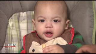 Giving peanut-based foods to babies early prevents allergies
