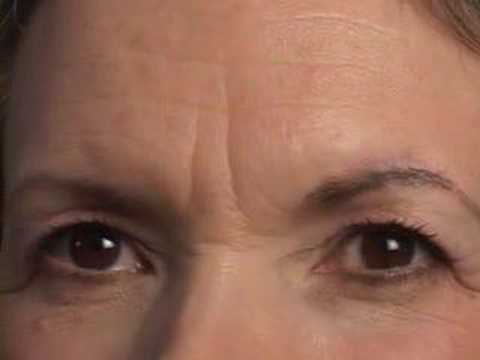 HAIR TRANSPLANT CLOSEUP:  EYEBROW RECONSTRUCTION