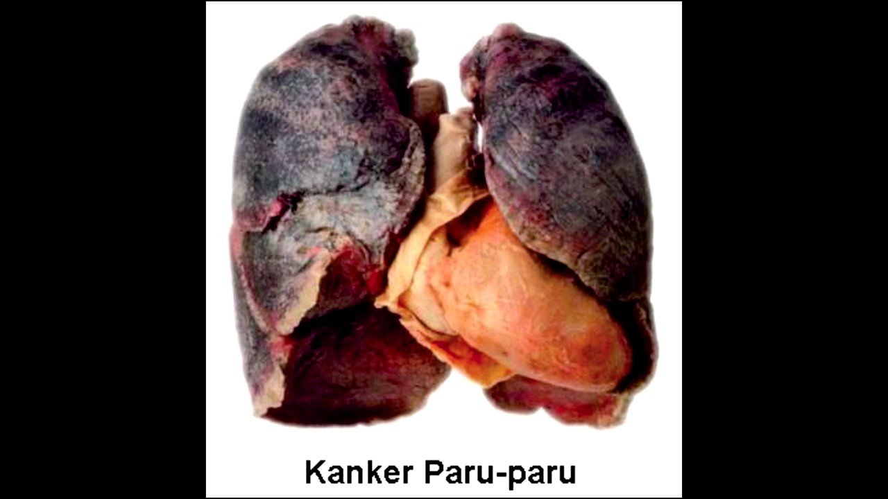 IKLAN LAYANAN MASYARAKAT BAHAYA MEROKOK - YouTube