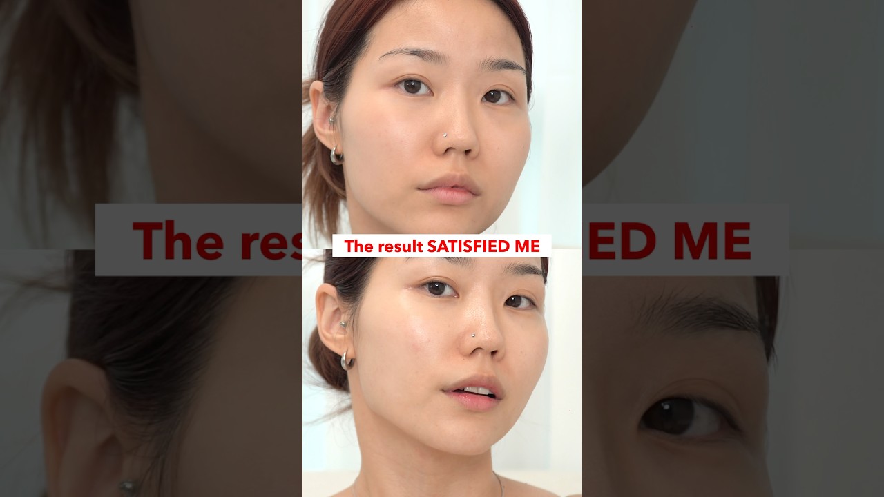 What happens when you use ONLY VITAMIN C for a week? #vitaminc #brighteningskin #skincare