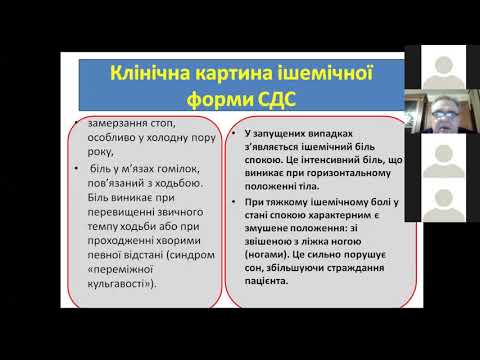 Діагностика та лікування синдрому діабетичної стопи