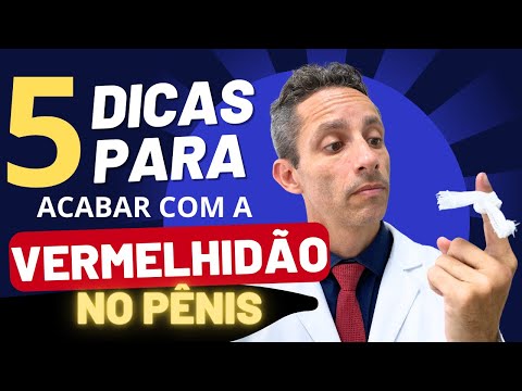 5 DICAS PARA ACABAR COM A VERMELHIDÃO DO PÊNIS | Prevenção da Balanopostite de Repetição