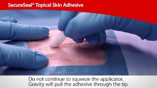 SecureSeal® Topical Skin Adhesive | Cardinal Health screenshot 5