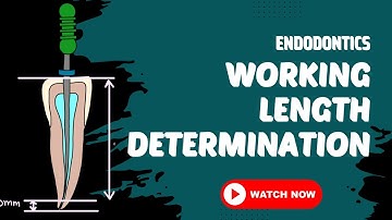 ENDODONTICS | WORKING LENGTH DETERMINATION  | Root Canal Treatment