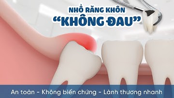 Nhổ răng khôn An Toàn - Không Biến Chứng - Lành Thương Nhanh - CHỈ TỪ 500K | Nha khoa Smart