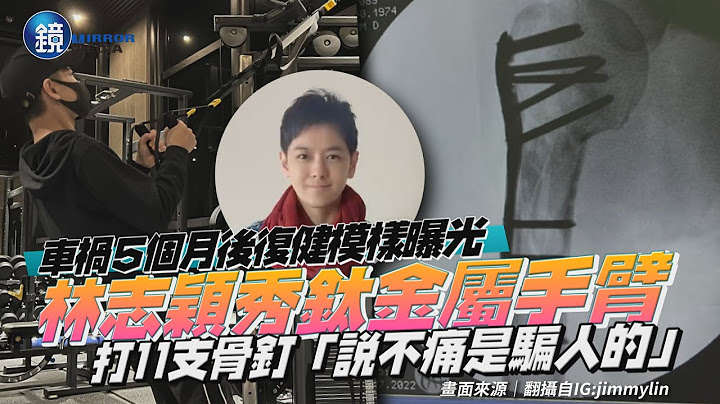 车祸5个月后复健模样曝光！林志颖秀钛金属手臂　打11支骨钉“说不痛是骗人的”｜镜周刊 - 天天要闻