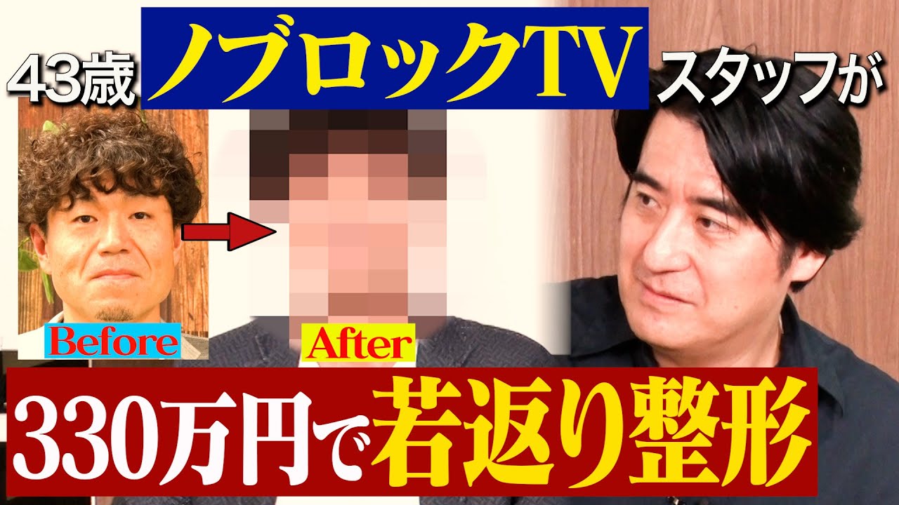 【ガチ整形】43歳ノブロックTVスタッフのおじさんが330万円かけて整形したので話を聞いてみた