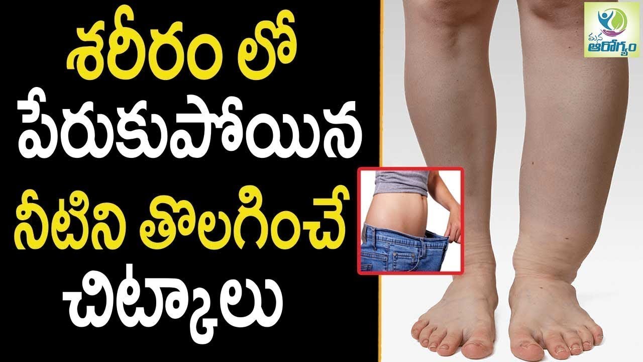 Water Retention Ayurvedic Remedies Health Tips In Telugu Mana Arogyam YouTube